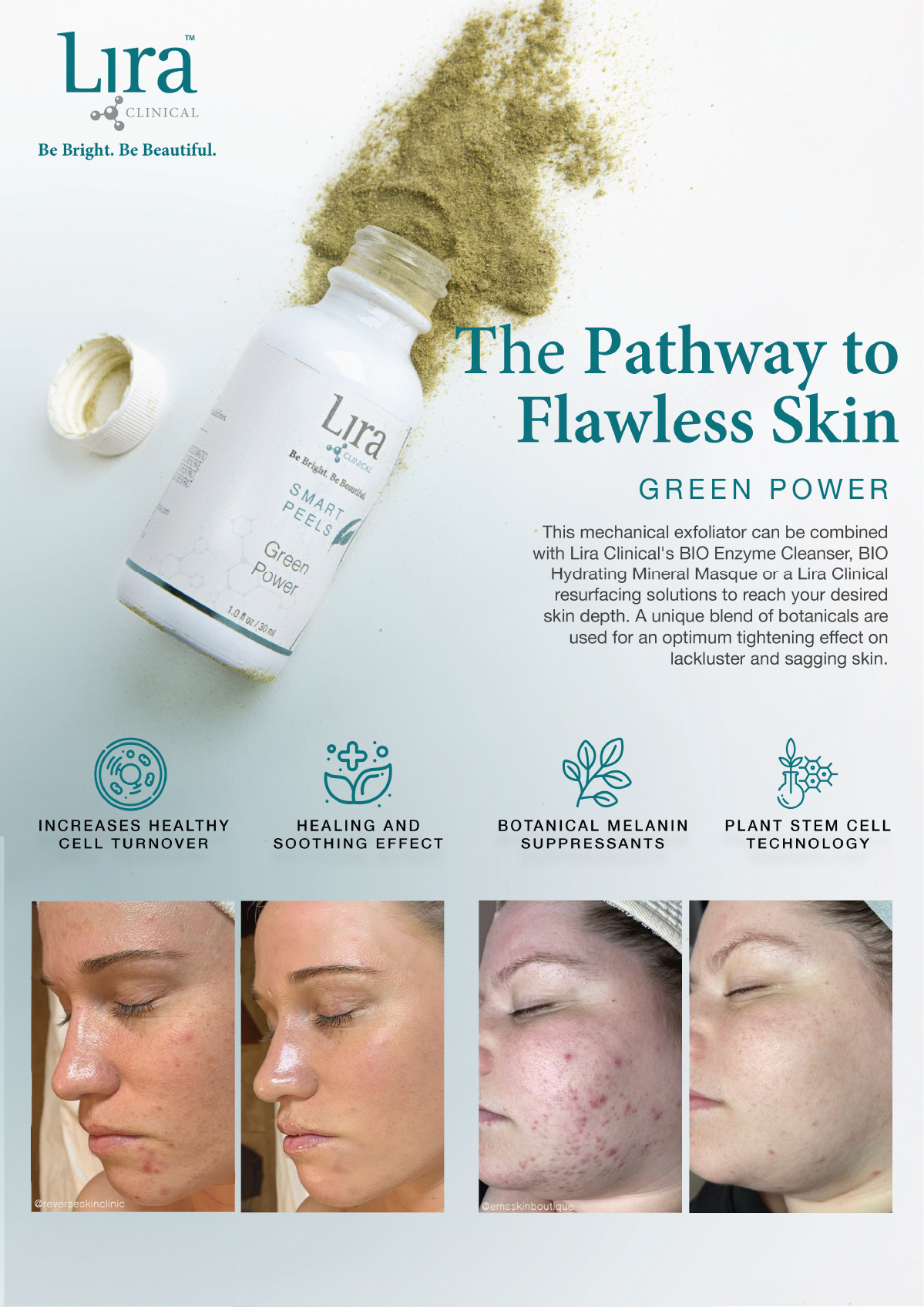 Lira A4 - Green Power