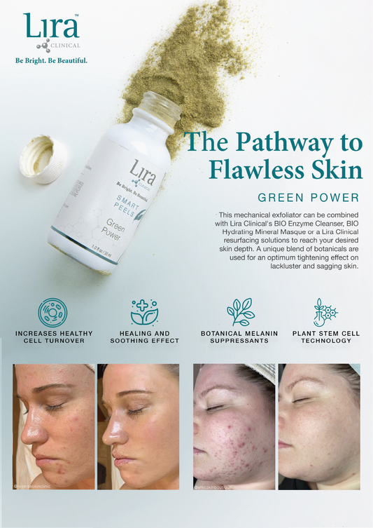 Lira A4 - Green Power